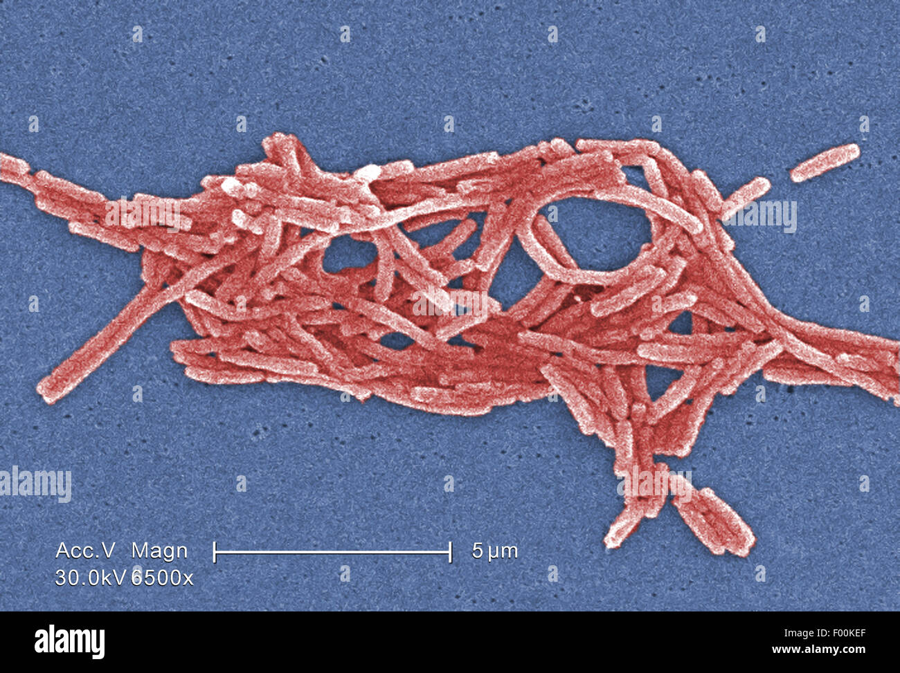 Colorea el análisis micrografía de electrones (SEM) representa un grupo de bacterias Gram-negativas la bacteria Legionella pneumophila. Mag 6500X Foto de stock