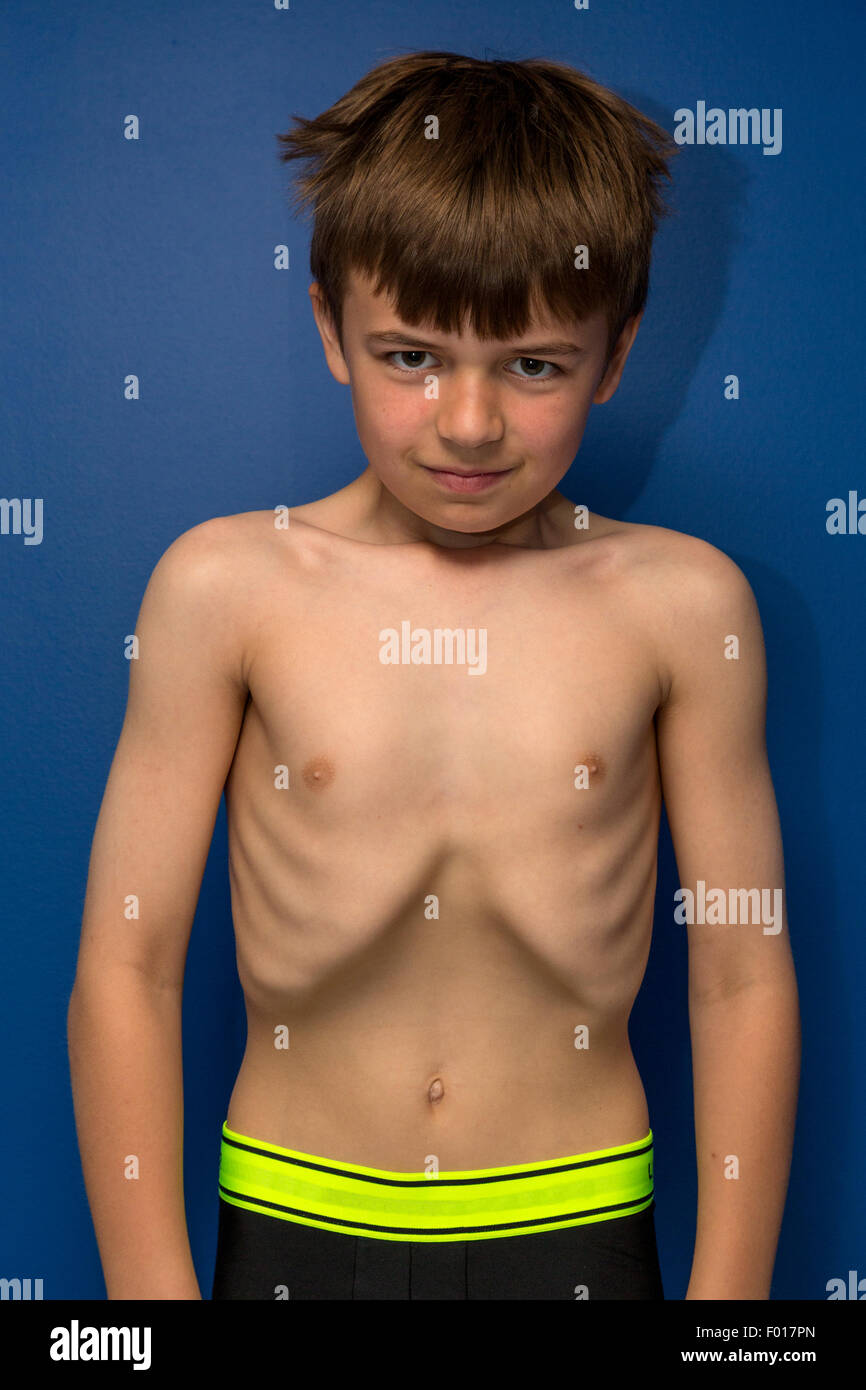 Joven (edad 9) mostrando su caja torácica para divertirse. Señor Foto de stock