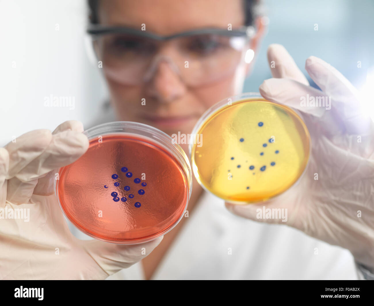Examen científico conjunto de placas de petri en el laboratorio de microbiología Foto de stock