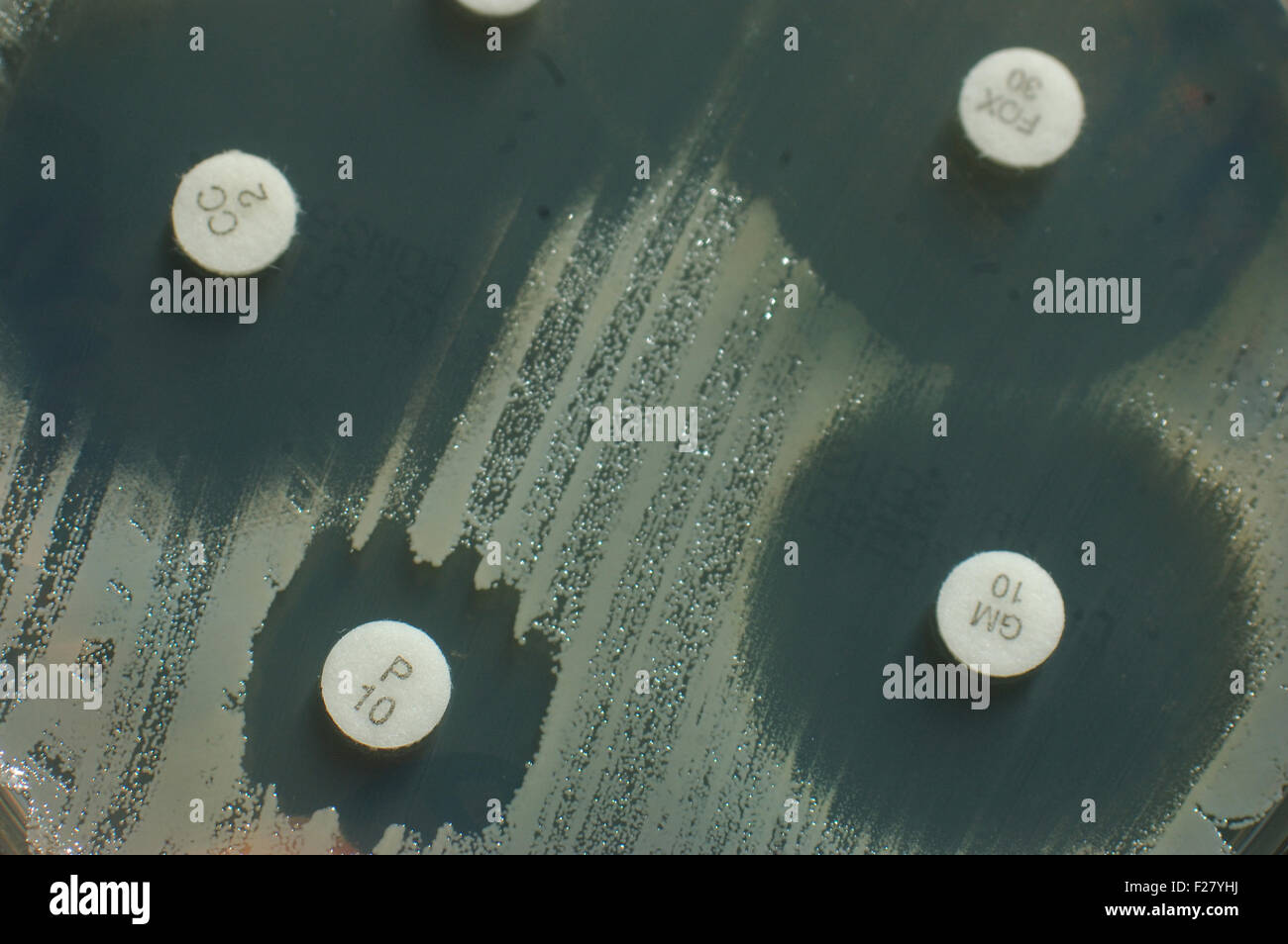 Placa de Petri con sensibilidad antibiótica discos mostrando zonas de inhibición para las colonias de bacterias Foto de stock