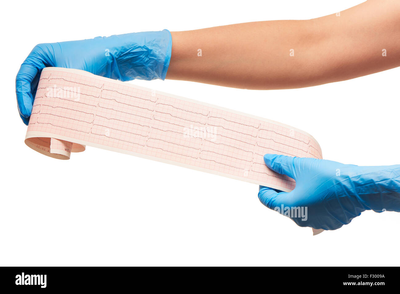 Cerca de manos del médico femenino en azul guantes quirúrgicos esterilizados con resultados de ECG en papel contra el fondo blanco. Foto de stock