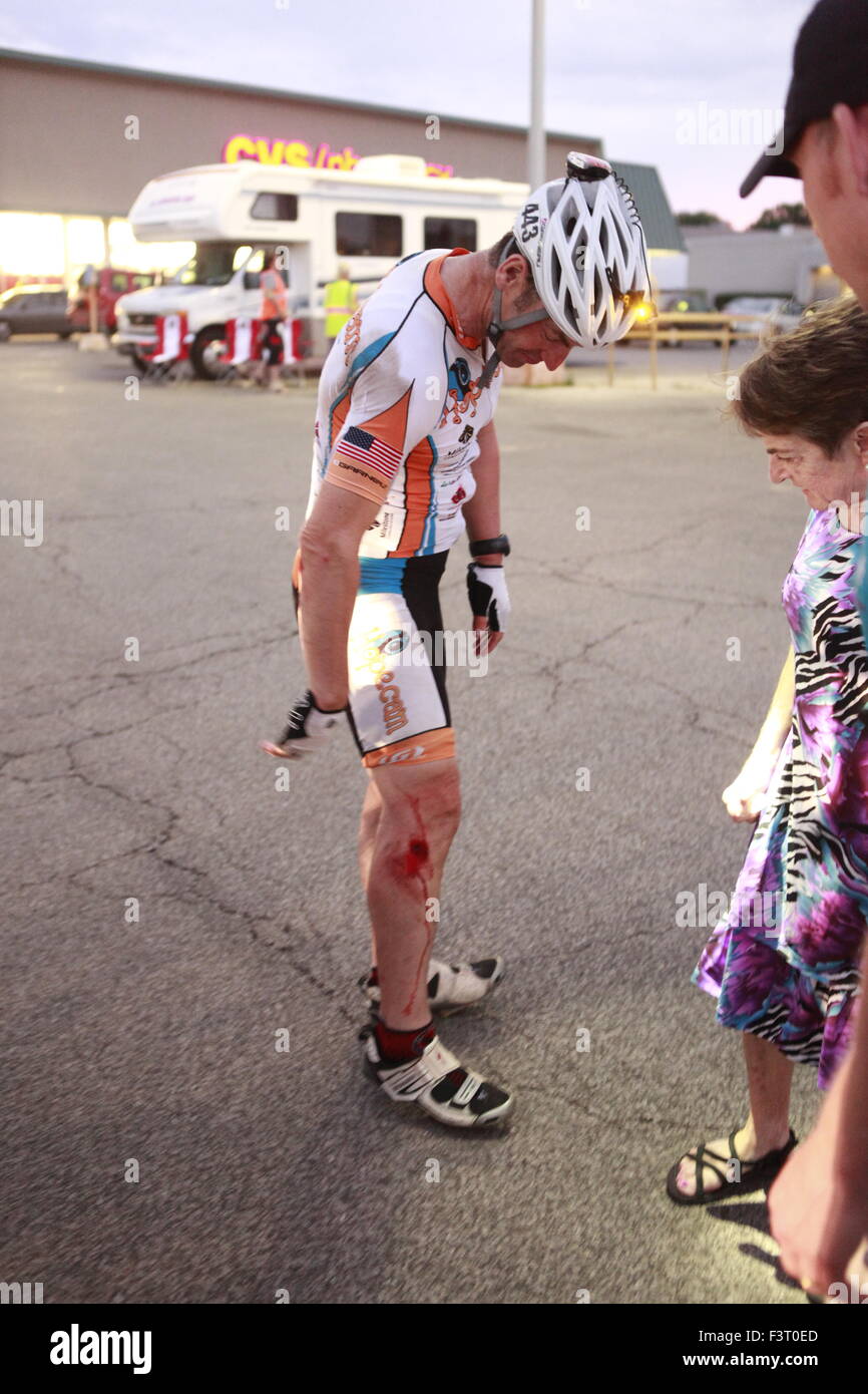 Len Forkas, un jinete solitario, muestra heridas después de que se estrelló cerca de Checkpoint 39 durante la Race Across America ultrmarathon carrera en bicicleta. estaba luchando contra el agotamiento