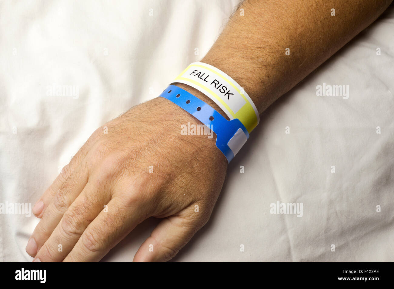 Paciente hospitalizado con riesgo de caída la pulsera en la muñeca. Foto de stock