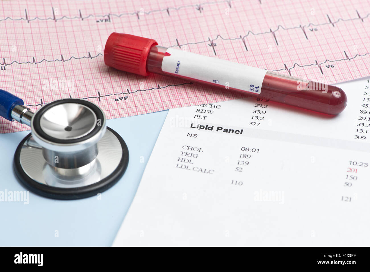 Prueba de lipidos fotografías e imágenes de alta resolución Alamy