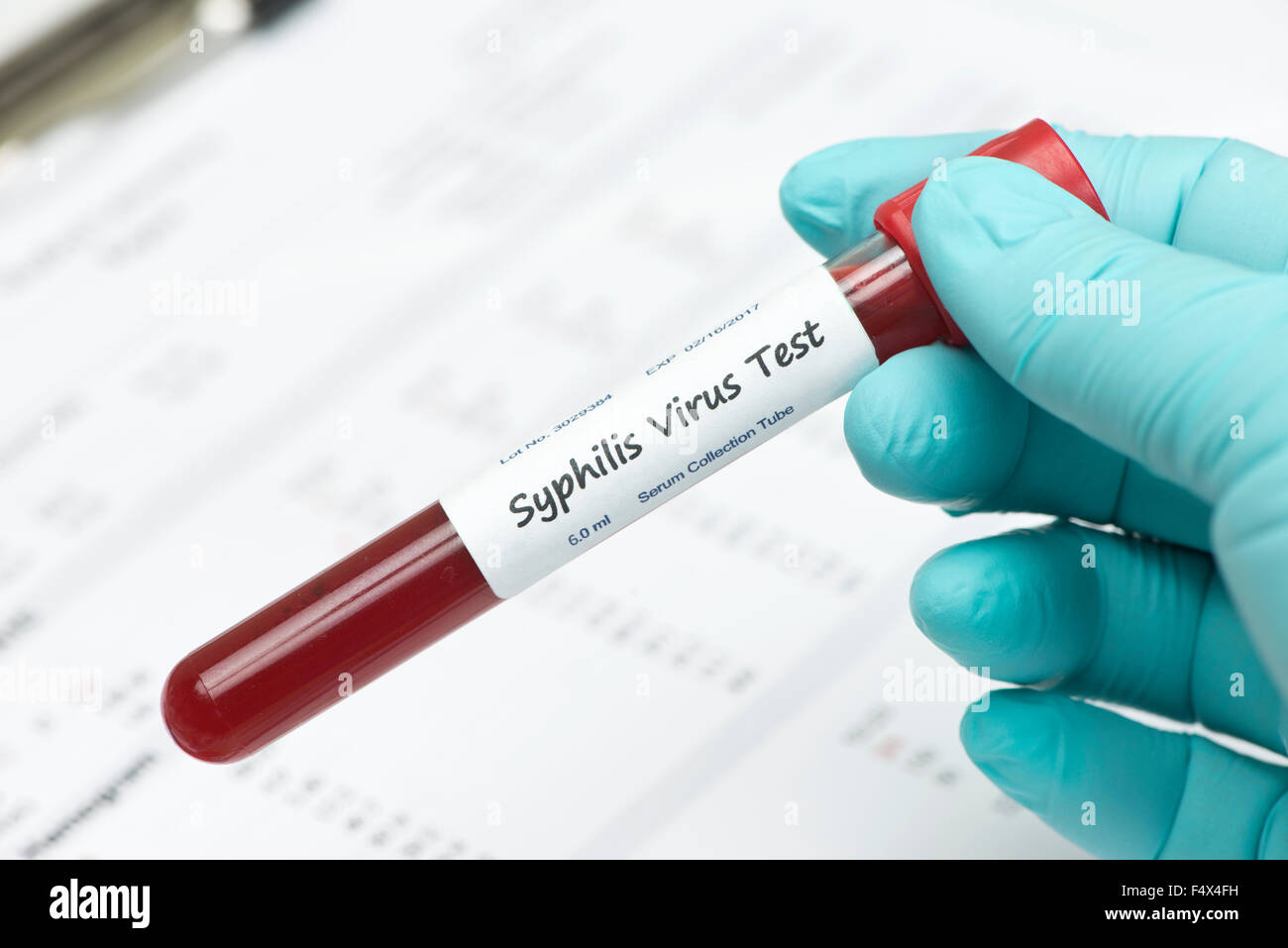 Sífilis virus tubo de recogida de muestras de sangre celebrada por técnico con informe de laboratorio. La etiqueta es ficticio, números de serie son aleatorias Foto de stock