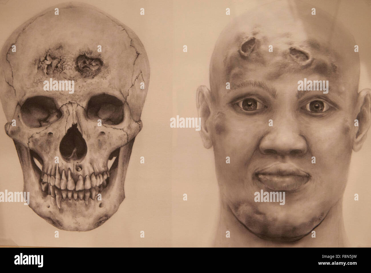 Síntomas de la sífilis facial fotografías e imágenes de alta resolución -  Alamy