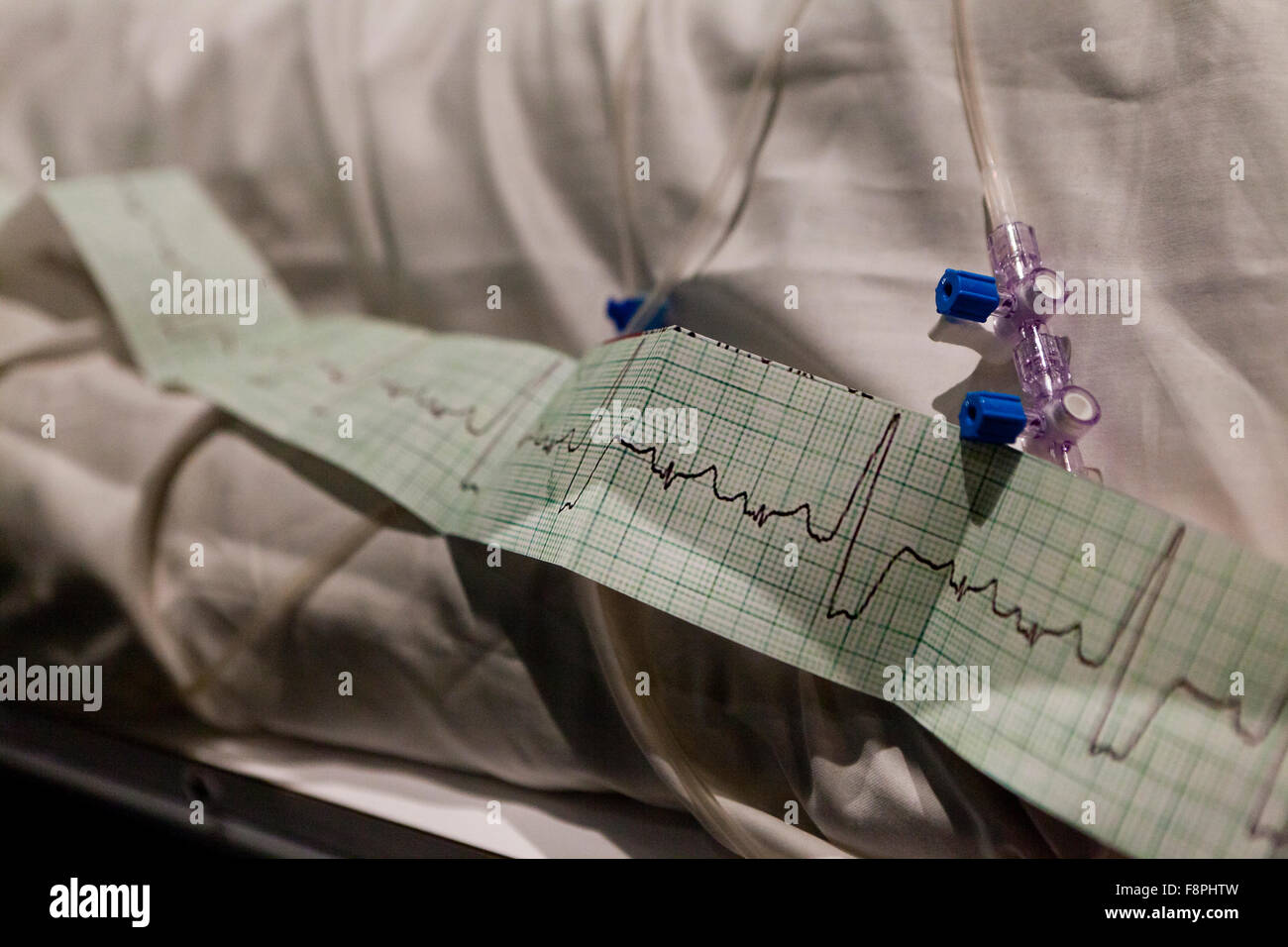 Monitor de ritmo cardíaco cinta en medical imprimir cinta - EE.UU. Foto de stock