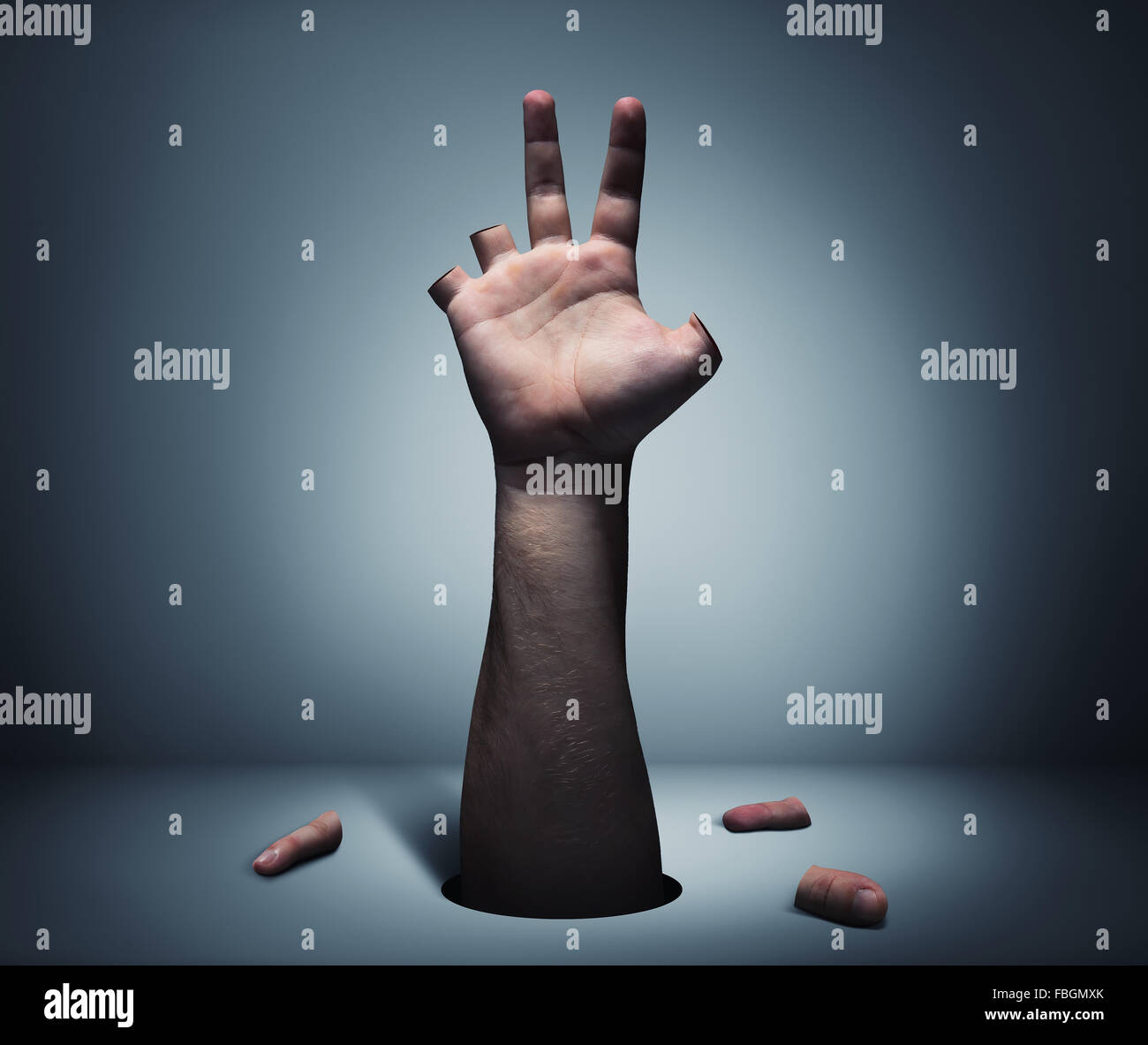 La mano humana con dedos cortados Foto de stock