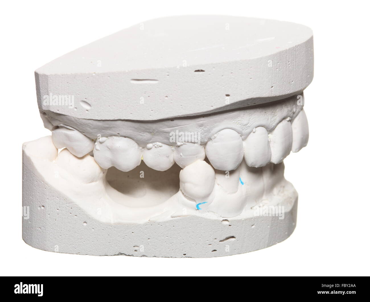 Modelo de yeso dental de dientes del molde en yeso Fotografía de stock -  Alamy