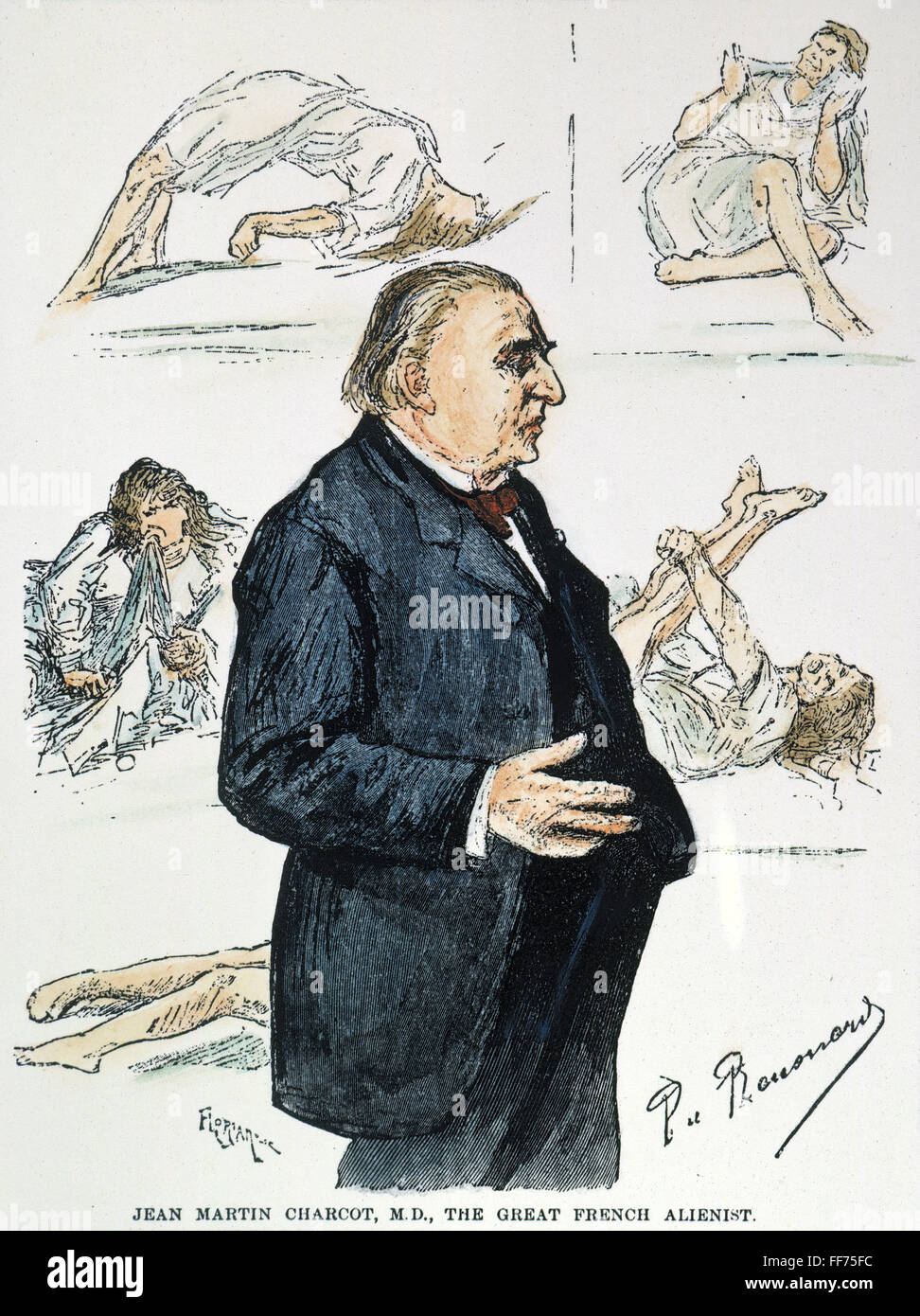 JEAN MARTIN CHARCOT /n(1825-1893). Neurólogo francés. Con los pacientes de su clínica neurológica en la Salpetriere, París: grabado pintado, 1887. Foto de stock