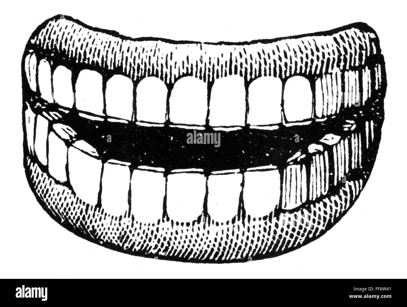 Las prótesis dentales, 1900. /Nlínea cortar. Foto de stock