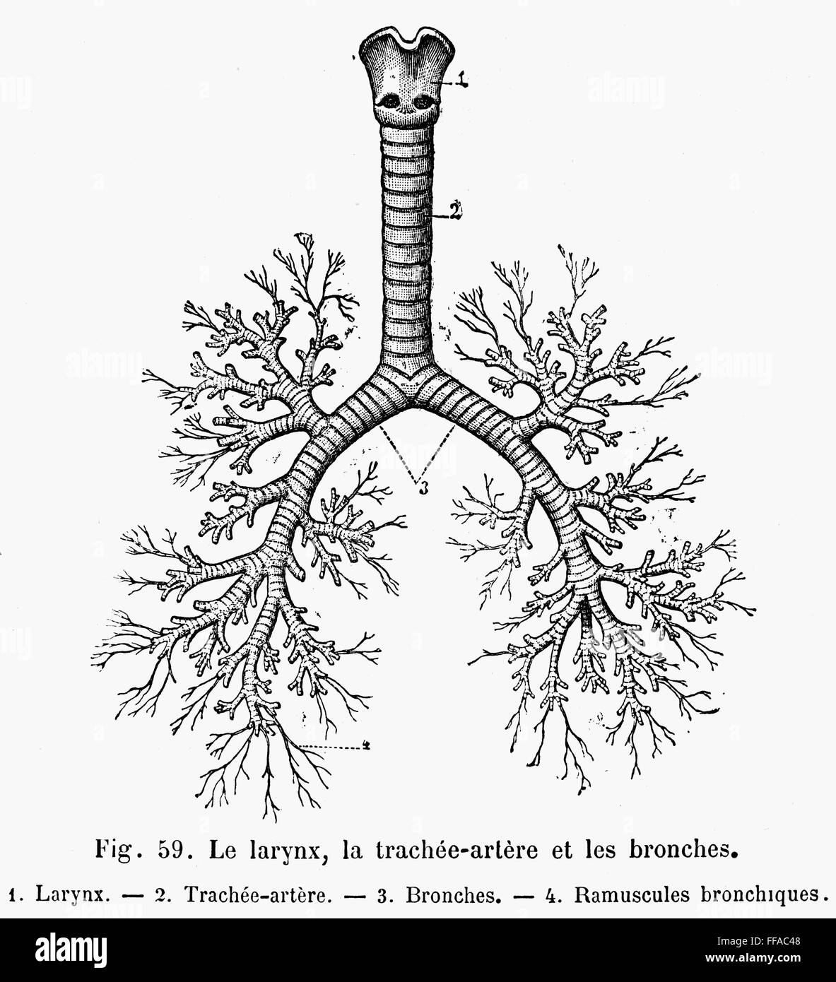 Слизистая оболочка бронхов выстлана. Топография бронхов анатомия. Трахея и бронхи вид спереди. Трахея и бронхи выстланы. Трахея процесс.