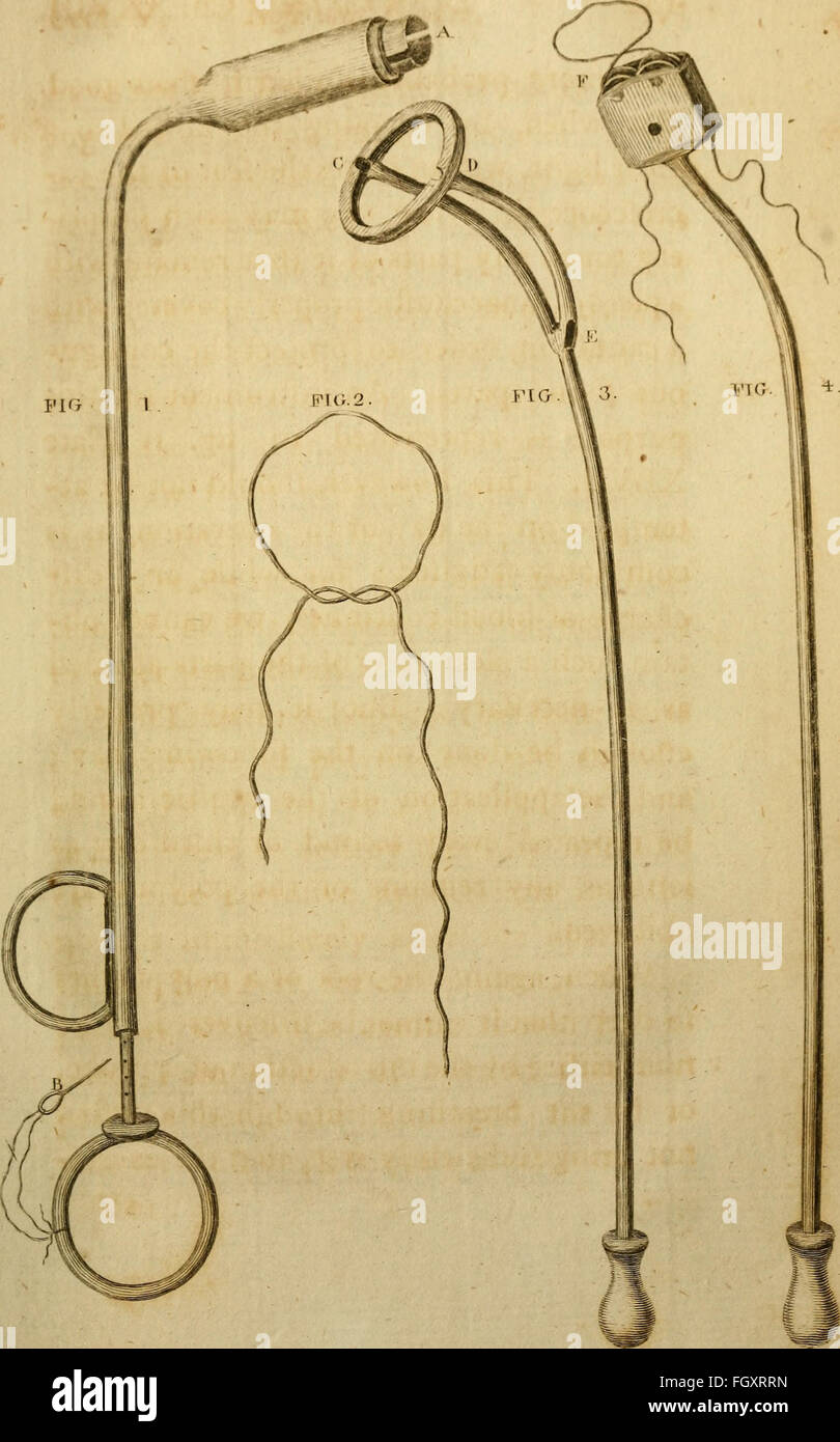 Un sistema de cirugía (1787) Foto de stock
