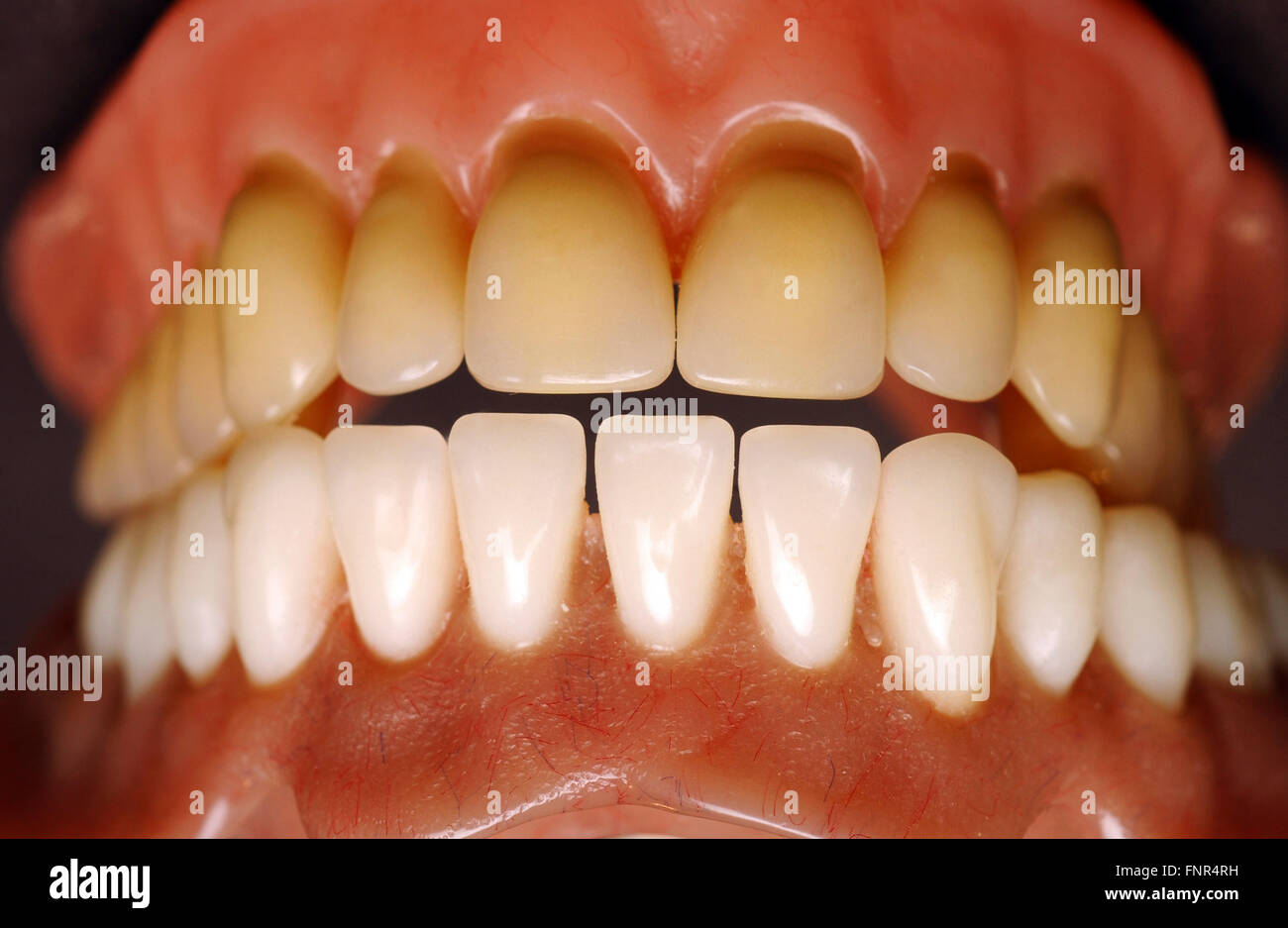 Close-up de una dentadura postiza. Foto de stock