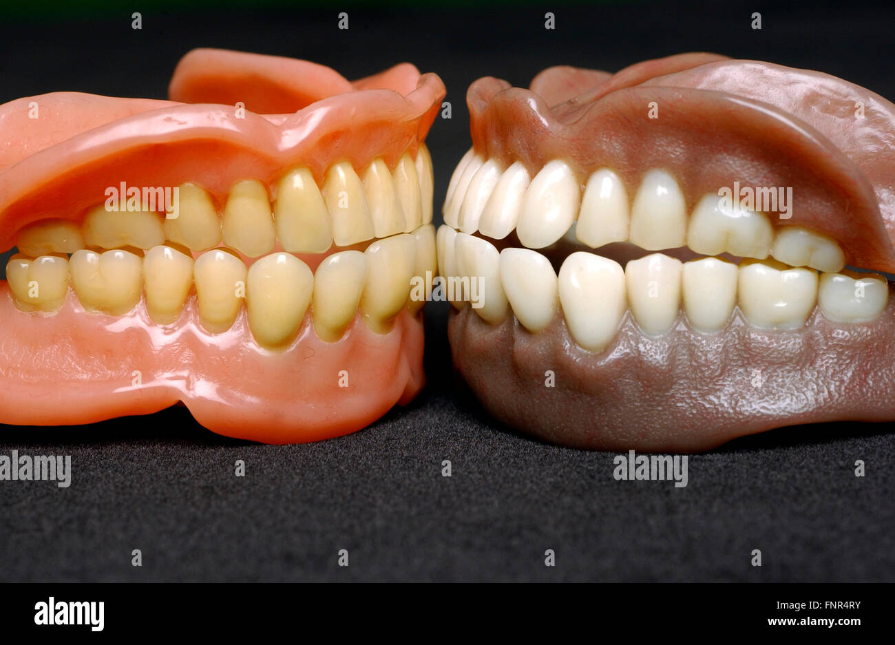 Dos conjuntos de dentadura completa. Las dentaduras postizas o los dientes postizos se hizo a partir de una base de acrílico acrílico o de cerámica en la que se montan los dientes. Foto de stock
