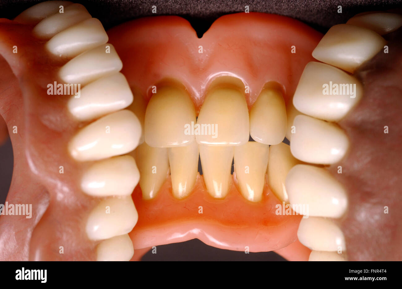 Cerca de dos conjuntos de dentaduras. Las dentaduras postizas o los dientes postizos se hizo a partir de una base de acrílico en la que los dientes son de cerámica o acrílico Foto de stock