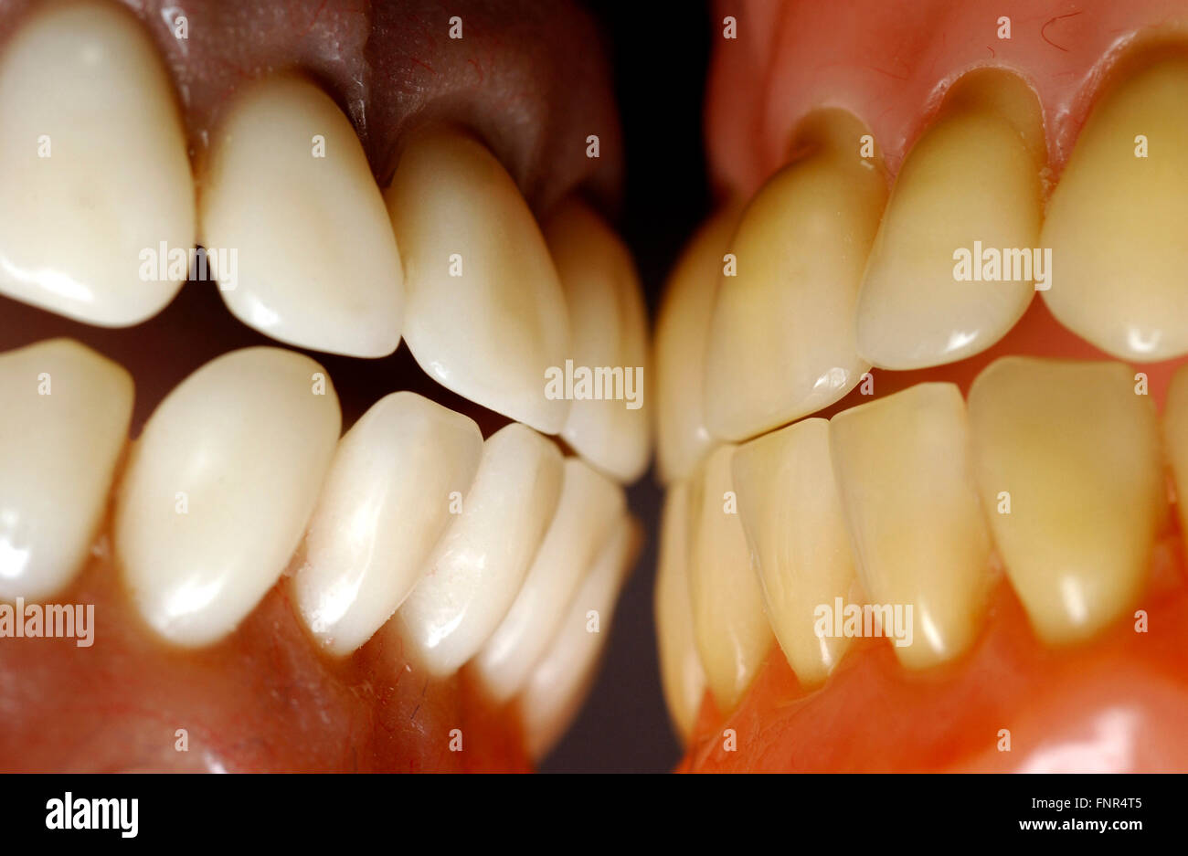 Close-up de dos conjuntos completos de dentaduras. Foto de stock