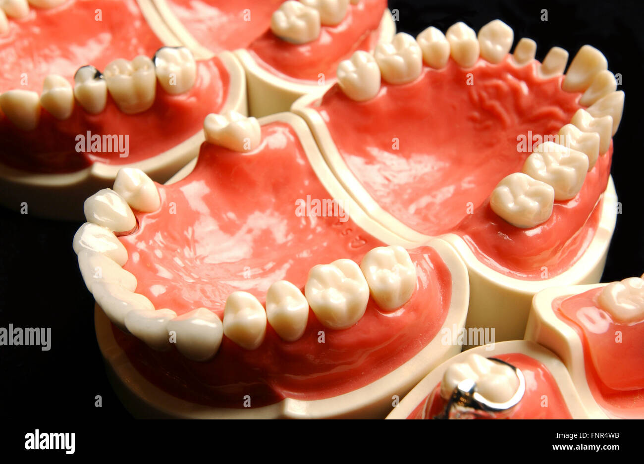 Una dentadura postiza. Las dentaduras postizas o los dientes postizos se  hizo a partir de una base de acrílico acrílico o de cerámica en la que se  montan los dientes. Las dentaduras