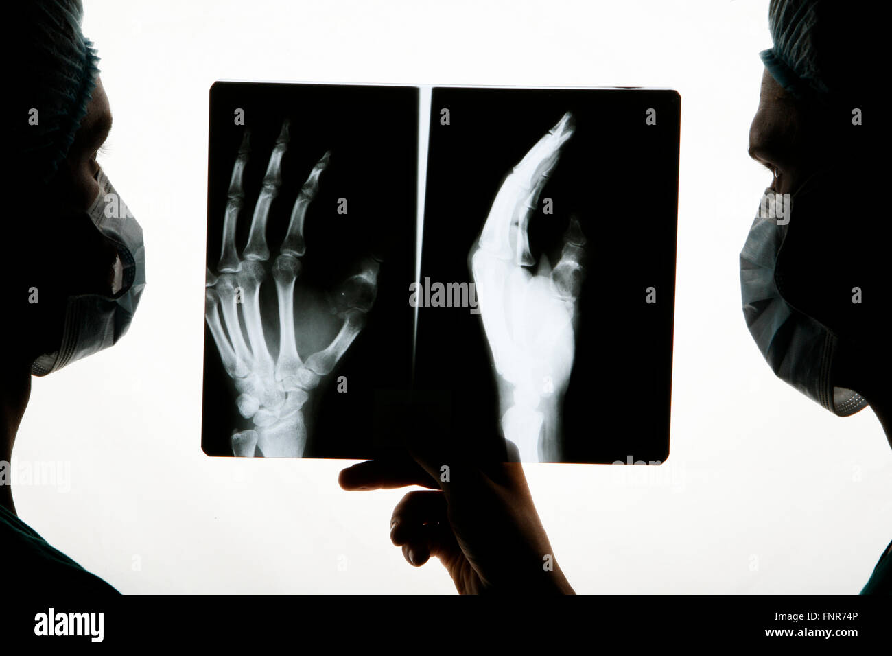 Dos cirujanos examinar una radiografía de la mano antes de la cirugía. Foto de stock