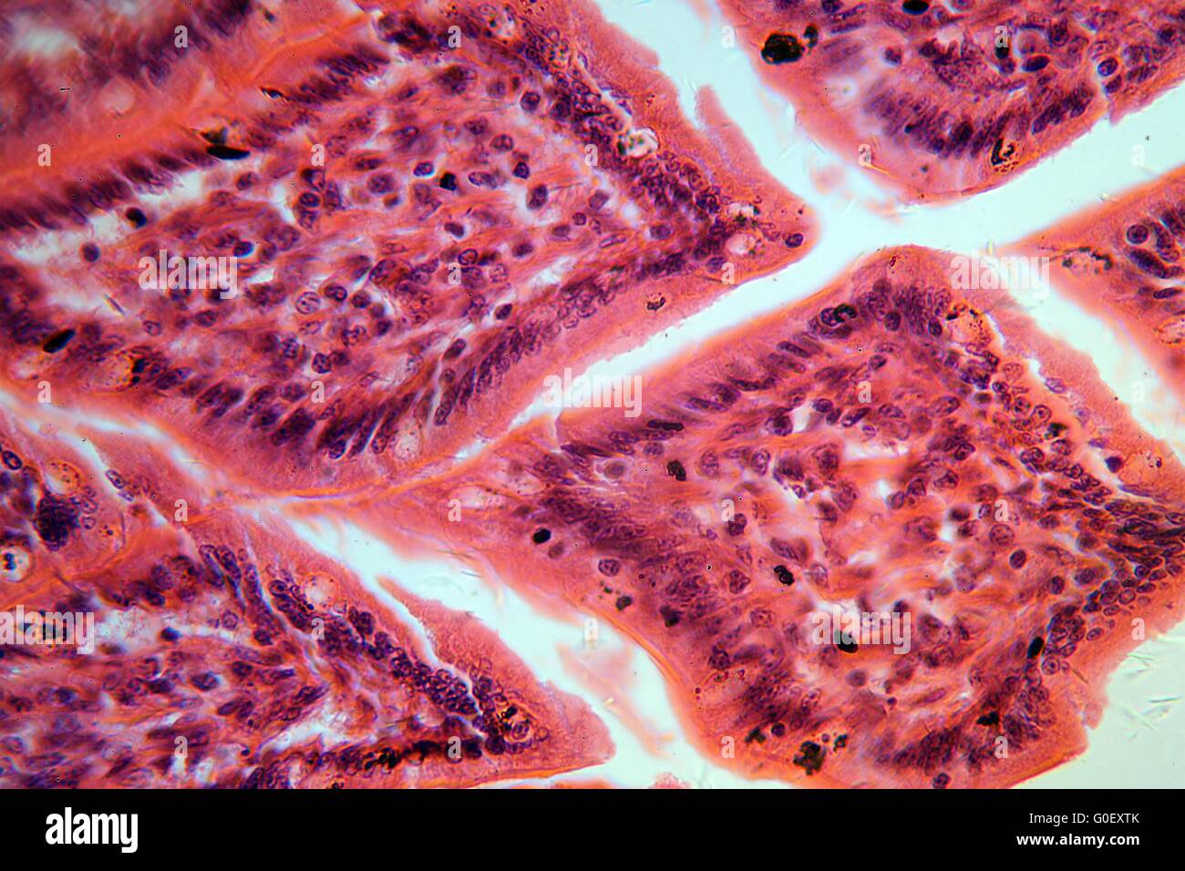 Una sección a través de las células del intestino delgado bajo el microscopio. Foto de stock