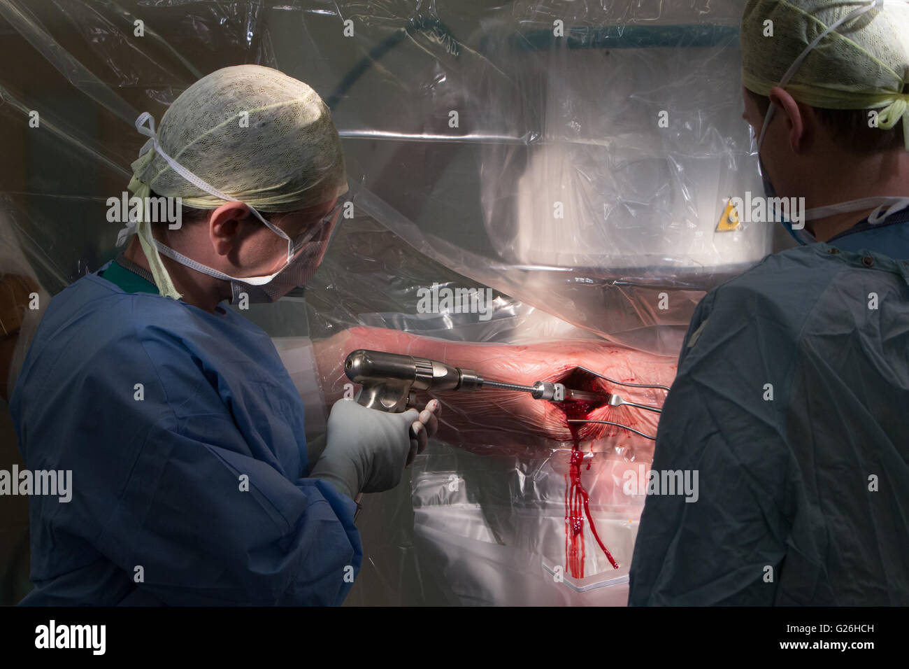 Cirujano en el teatro trabajando en un tornillo de cadera izquierda descompresión operación.uo de cerrar la operación. Foto de stock