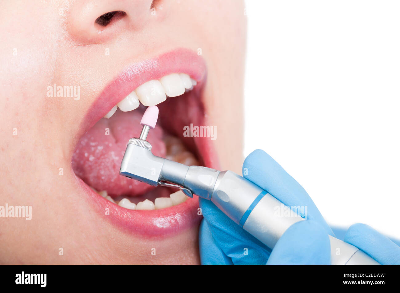 Dentista ussing rosa pulido de piedras para remover la placa de los dientes  en el consultorio dental Fotografía de stock - Alamy