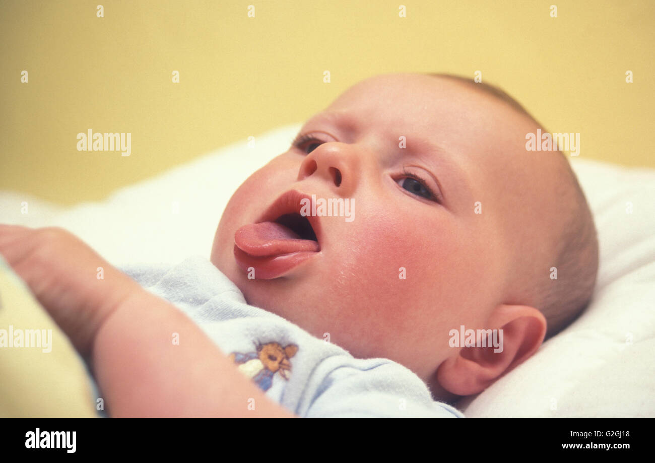 bebé con fiebre tos Foto de stock