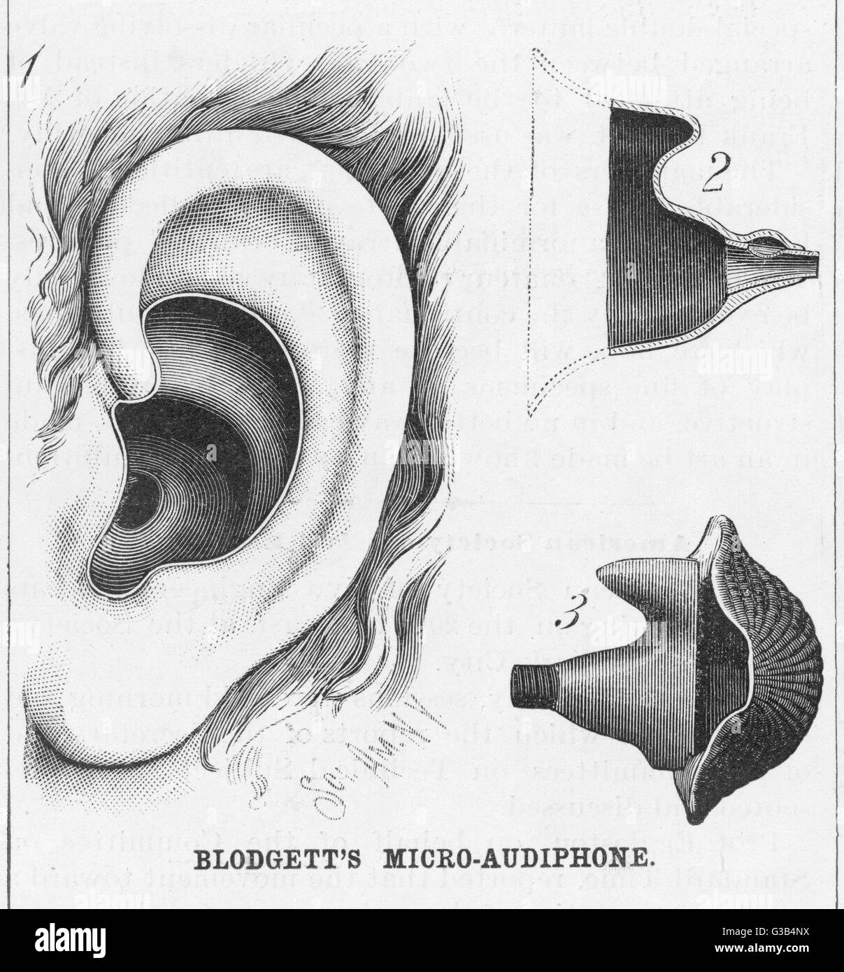 Diagramas para mostrar Blodgett de micro-audiphone audífono y cómo se inserta en el oído Fecha: 1886 Foto de stock