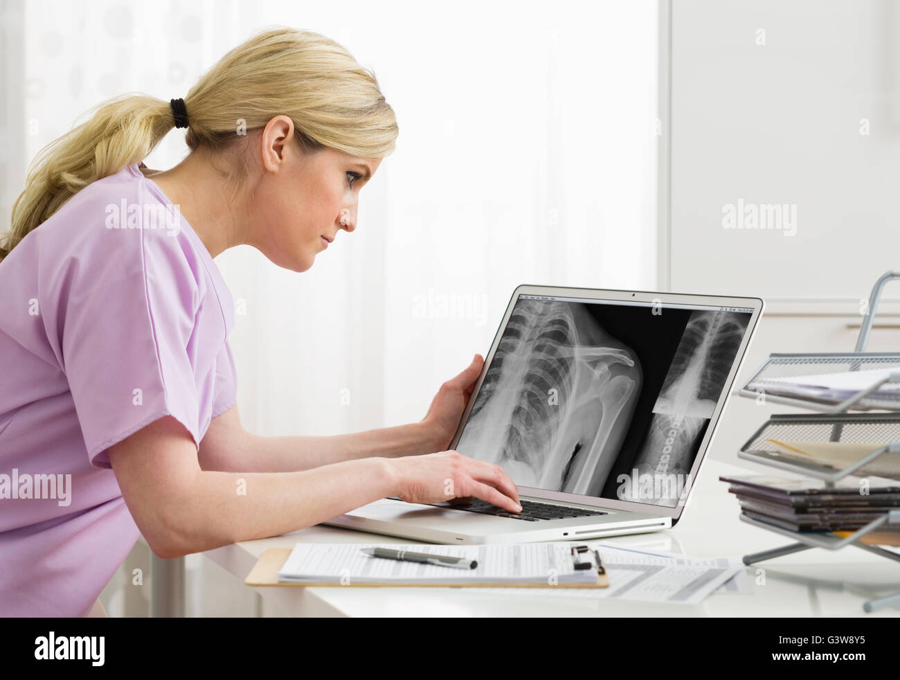 Doctora en análisis de imagen de rayos X en la pantalla de ordenador Foto de stock
