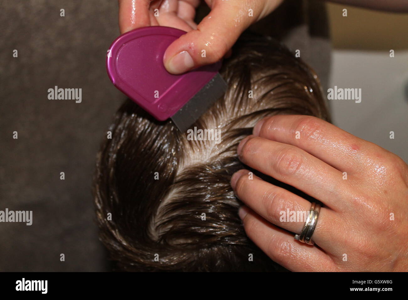 Los piojos de la cabeza, piojos, tratamiento de nits, deshacerse de los