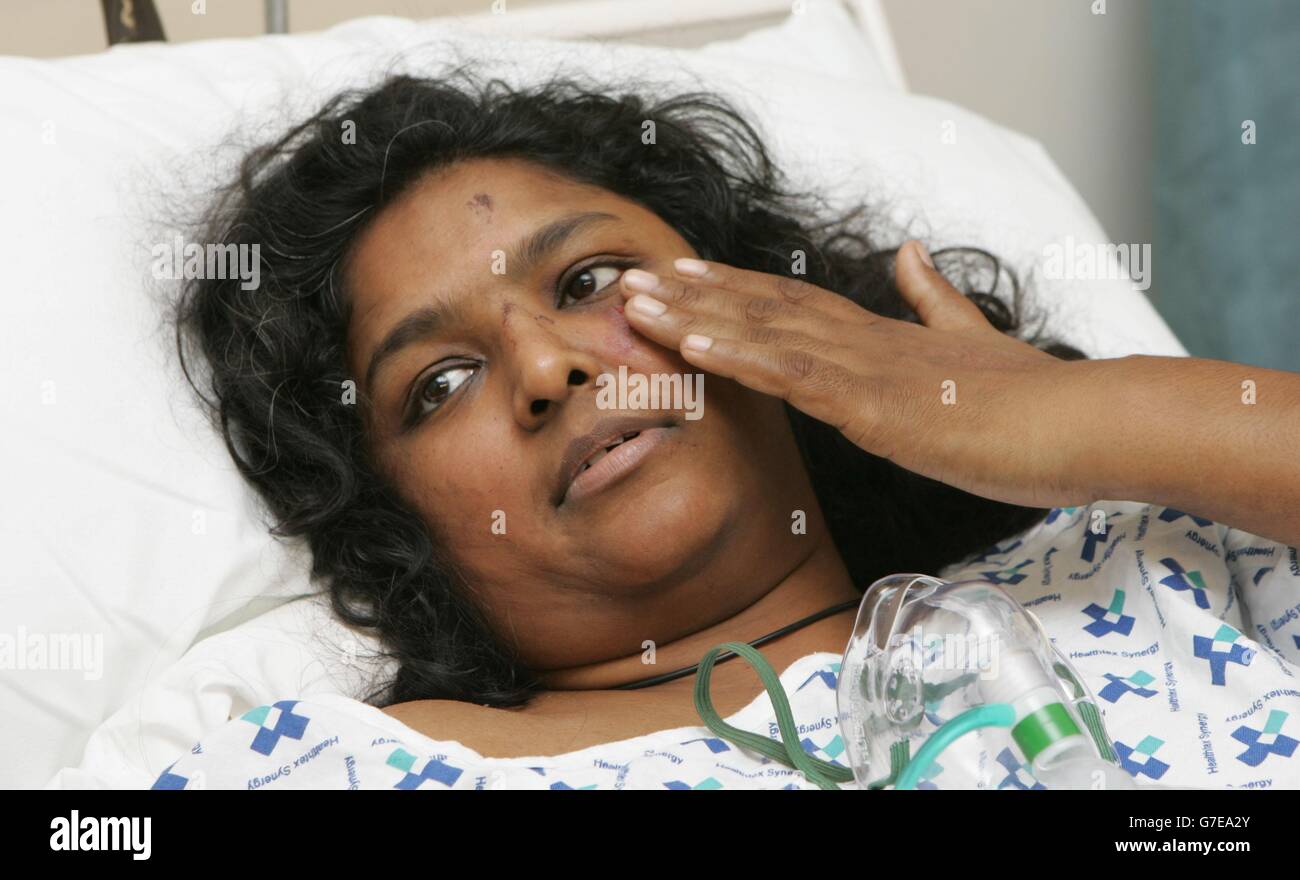 Sobreviviente del accidente de tren Sharmin Bacchus en el Hospital Royal Berkshire, Reading. Foto de stock