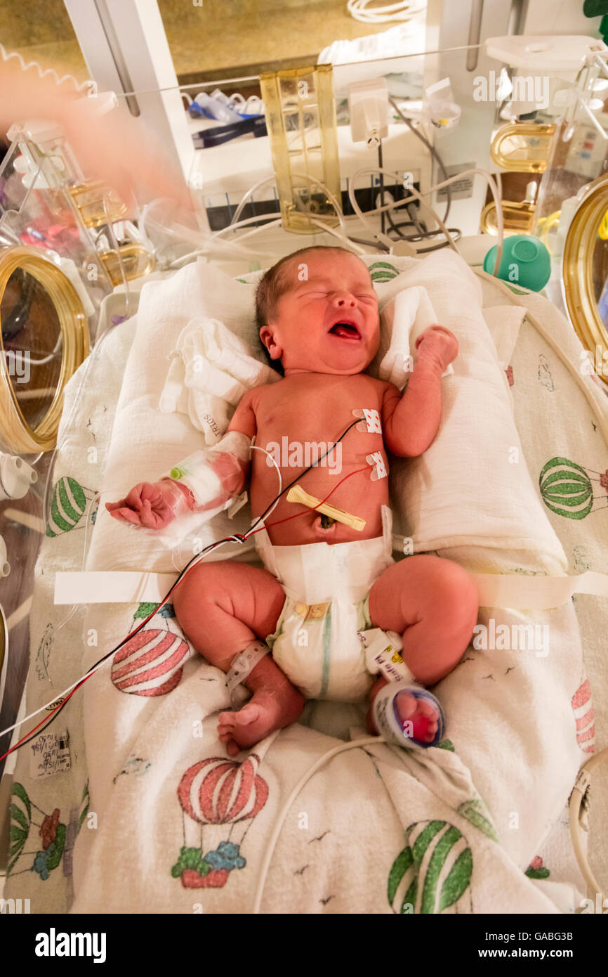 Un día viejo bebé prematuro en incubadora en natal, unidad de cuidados intensivos del Hospital General, tríos, Tri-Cities Kennewick, Washington Foto de stock