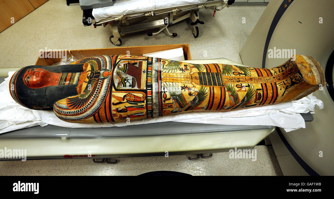 Una momia egipcia de 3,000 años se prepara para pasar por un escáner para ver lo que hay dentro en el University College Hospital en el centro de Londres. Foto de stock