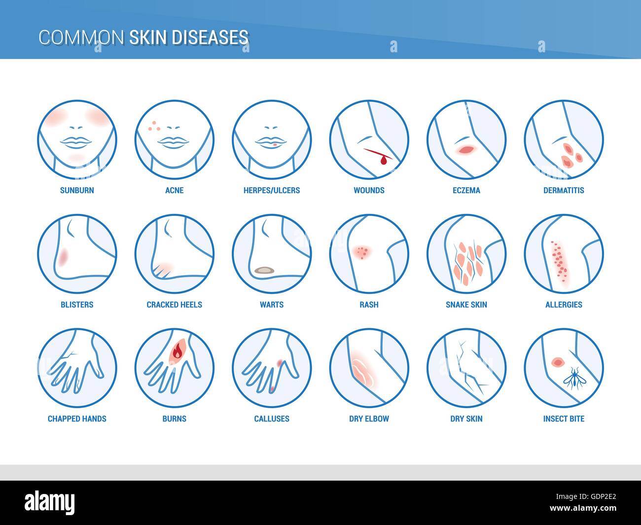 Iconos de las enfermedades de la piel y del cuerpo, salud y prevención Ilustración del Vector