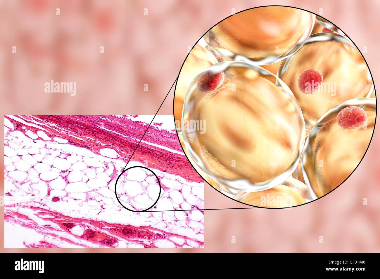 Las células de grasa, luz micrograph y equipo ilustración. Tejido adiposo blanco compuesto de adipocitos (células grasas). Los adipocitos forman el tejido adiposo, que almacena la energía como una capa aislante de grasa. Tejido adiposo blanco se utiliza como un almacén de energía sino también un Foto de stock