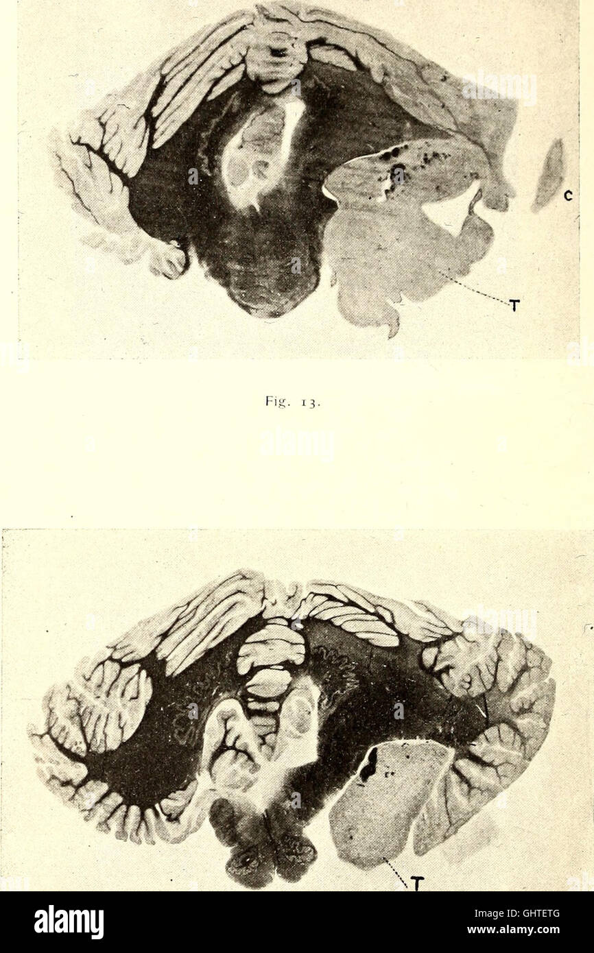 Gioenia Atti della Accademia di Scienze naturali en Catania (1915) Foto de stock
