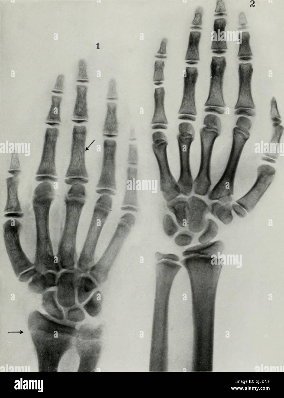 Viviendo la anatomía y de la patología; el diagnóstico de enfermedades en los primeros años de vida por el método Roentgen (1910) Foto de stock