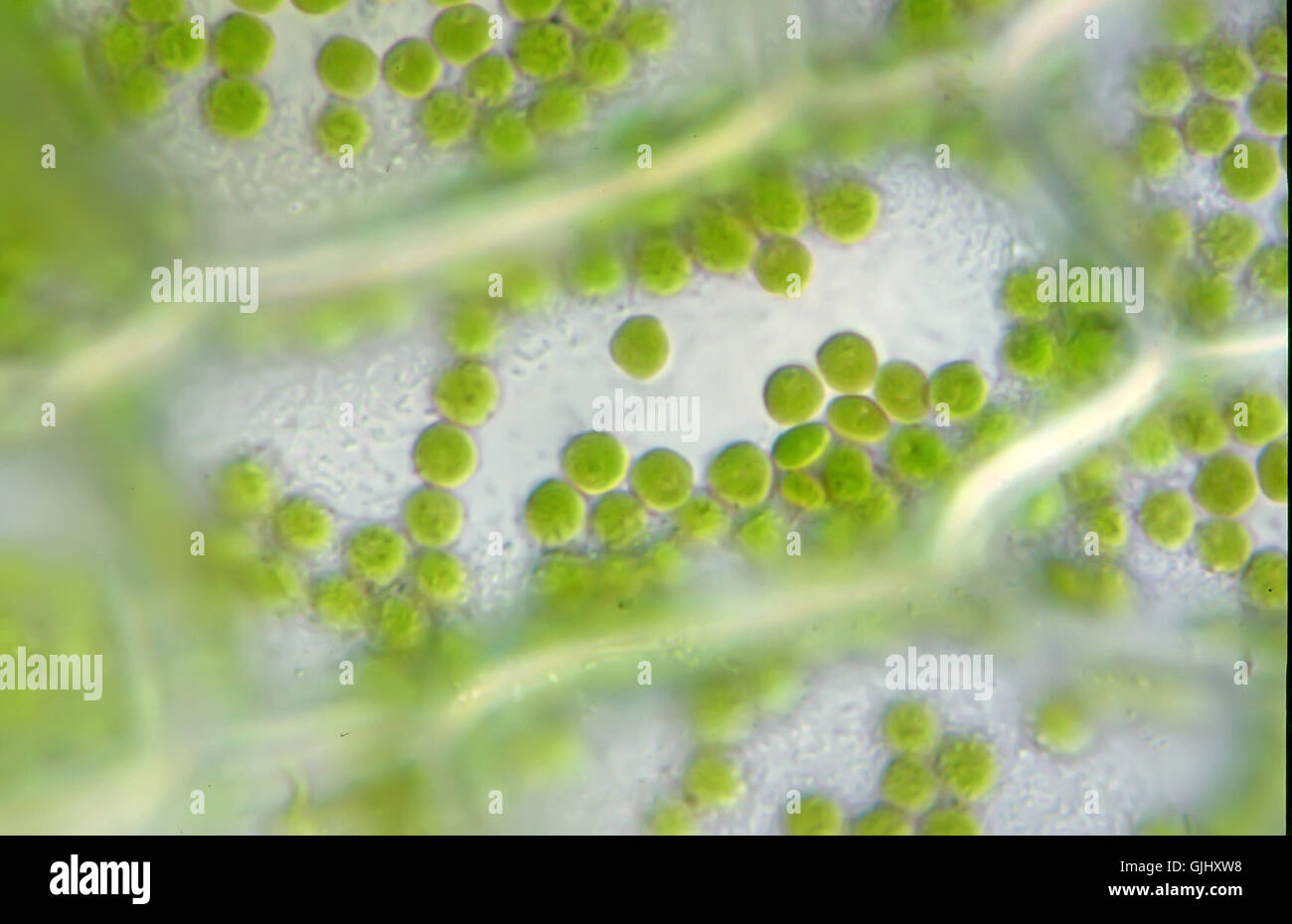 Las células vegetales con cloroplastos,microscópica Foto de stock