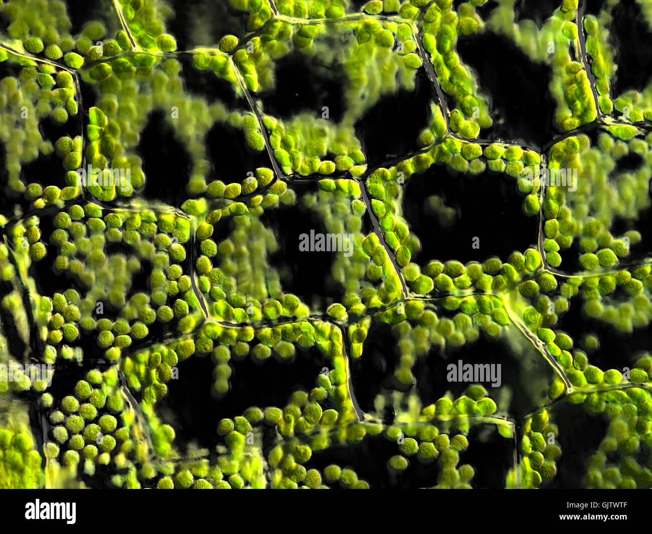 Las células vegetales con cloroplastos,microscópica Foto de stock