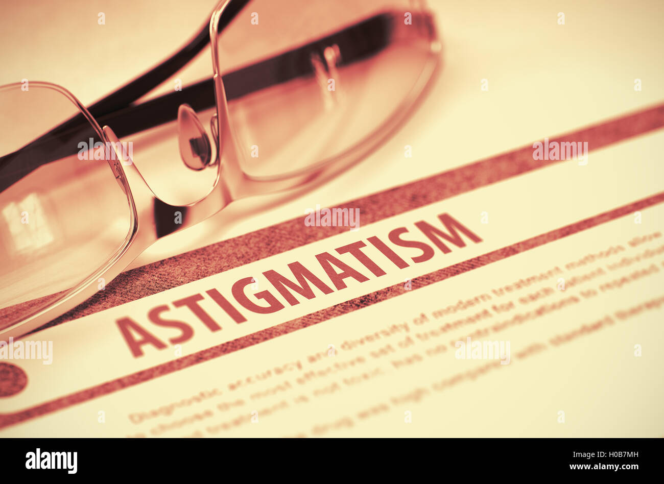 Diagnóstico - el astigmatismo. Concepto de medicina. Ilustración 3D. Foto de stock