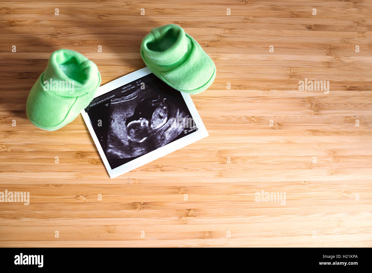 Ultrasound baby fotografías e imágenes de alta resolución - Alamy