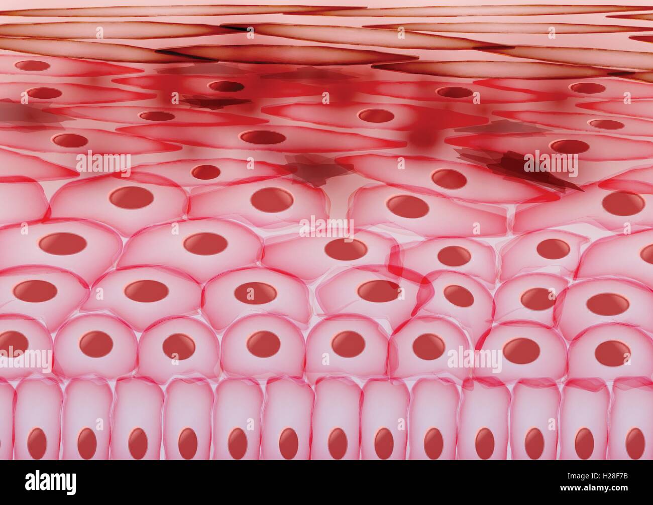 Las células de piel, eczema, piel inflamada capas Imagen Vector de stock Alamy