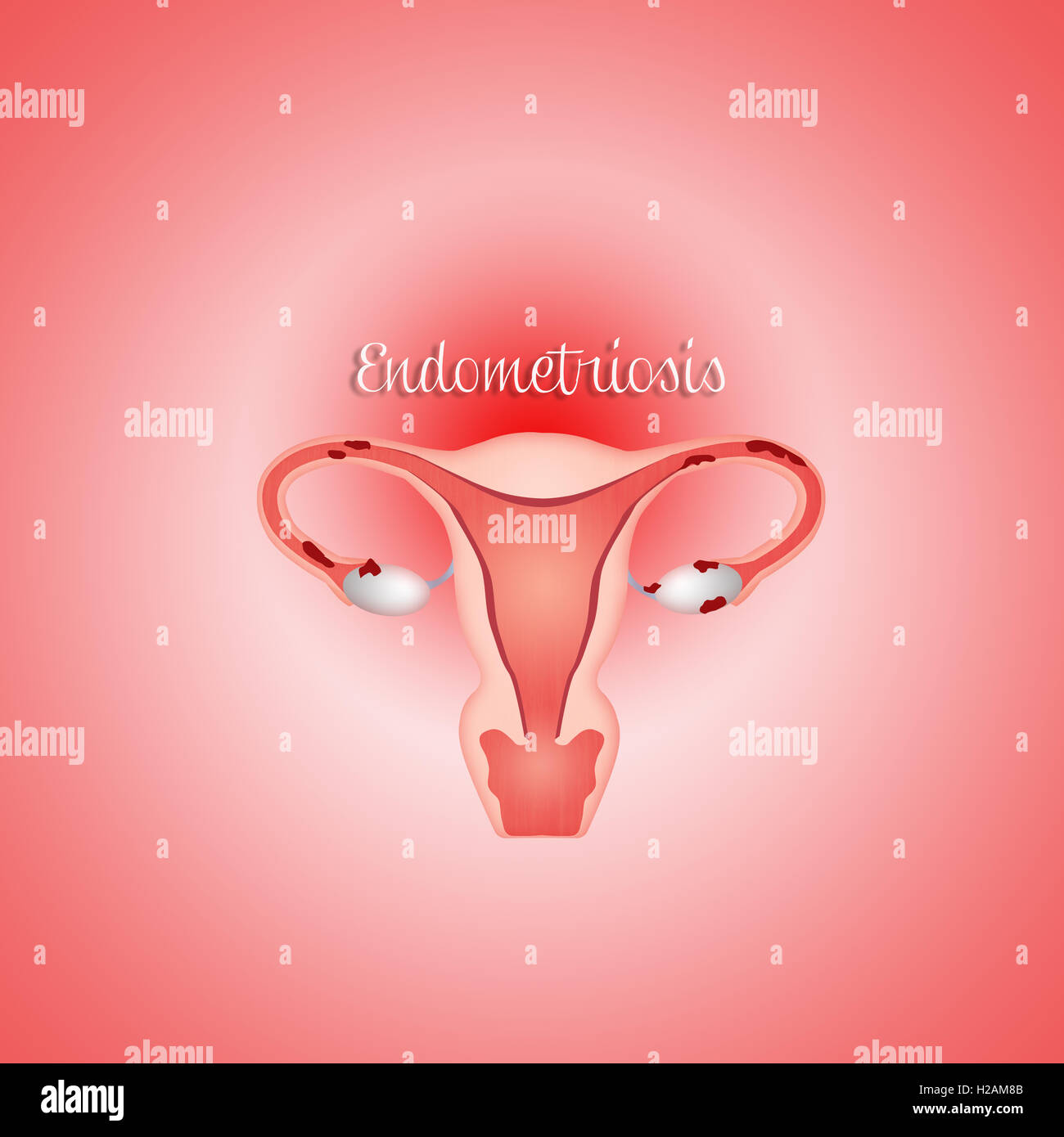 útero ovario fotografías e imágenes de alta resolución Alamy