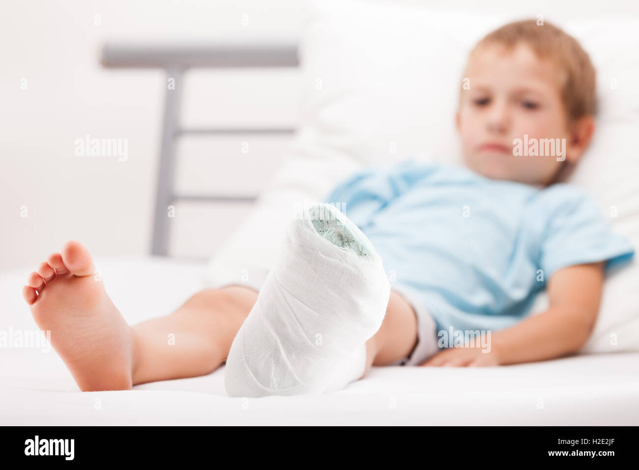 Niño pequeño muchacho con vendaje de yeso en el talón de la pierna fractura o br Foto de stock