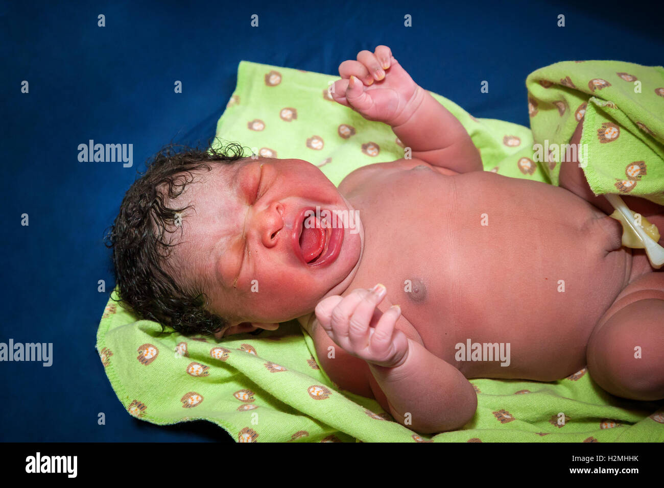 Umbilical Fotos E Imagenes De Stock Pagina 2 Alamy Umbilical Fotos E Imagenes De Stock Pagina 2 Alamy