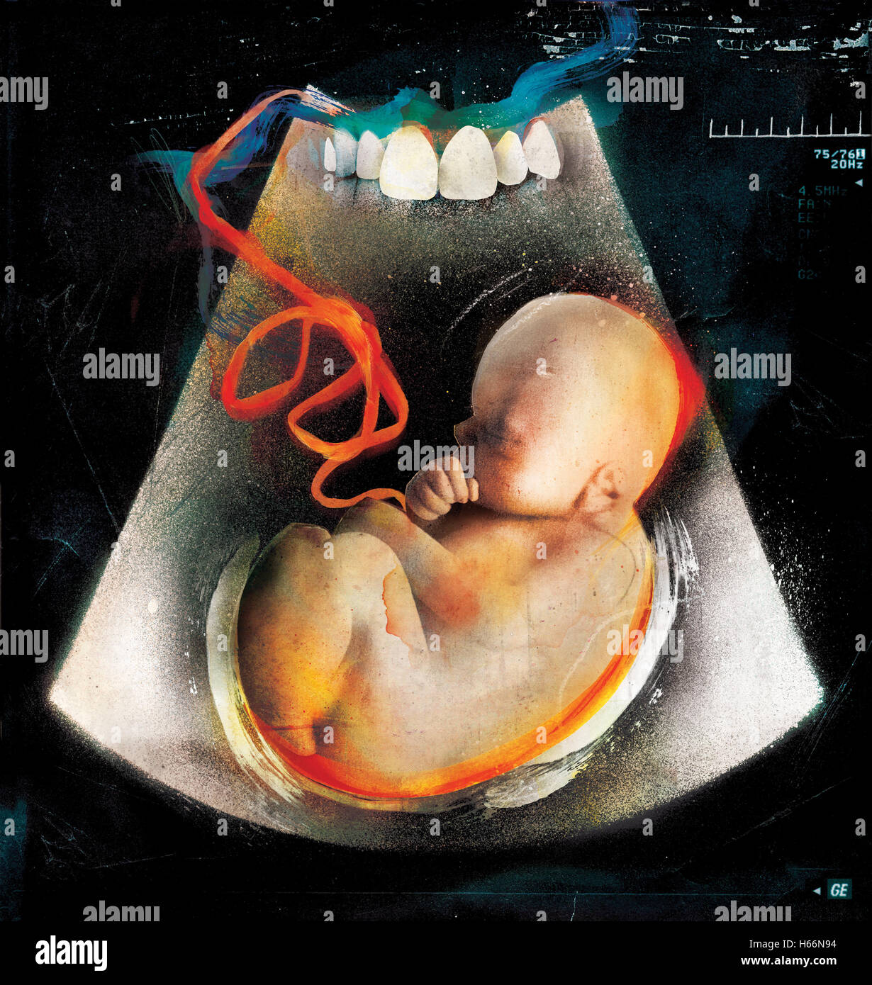 Imagen de rayos X del feto Foto de stock