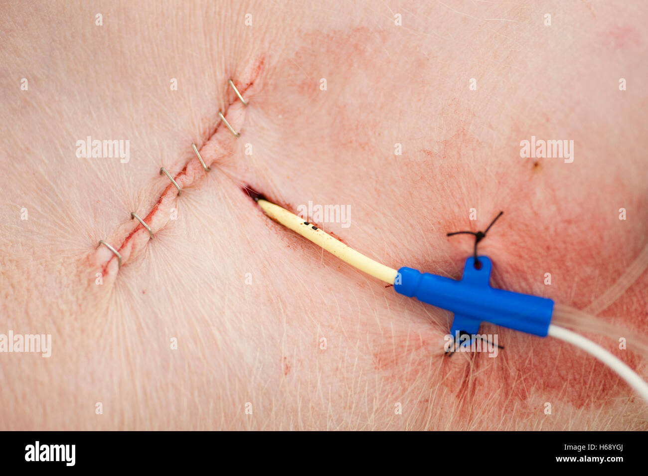 Los ensayos con animales, grapas quirúrgicas y el catéter en el cuello de  un cerdo Fotografía de stock - Alamy