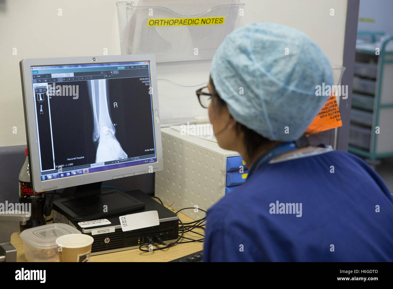 Una enfermera revisa una Rx de la tibia derecha en la pantalla durante una operación Foto de stock