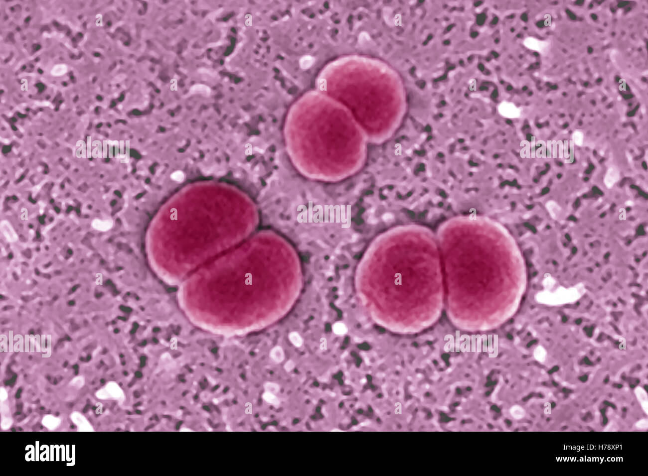 Neisseria meningitidis fotografías e imágenes de alta resolución Alamy