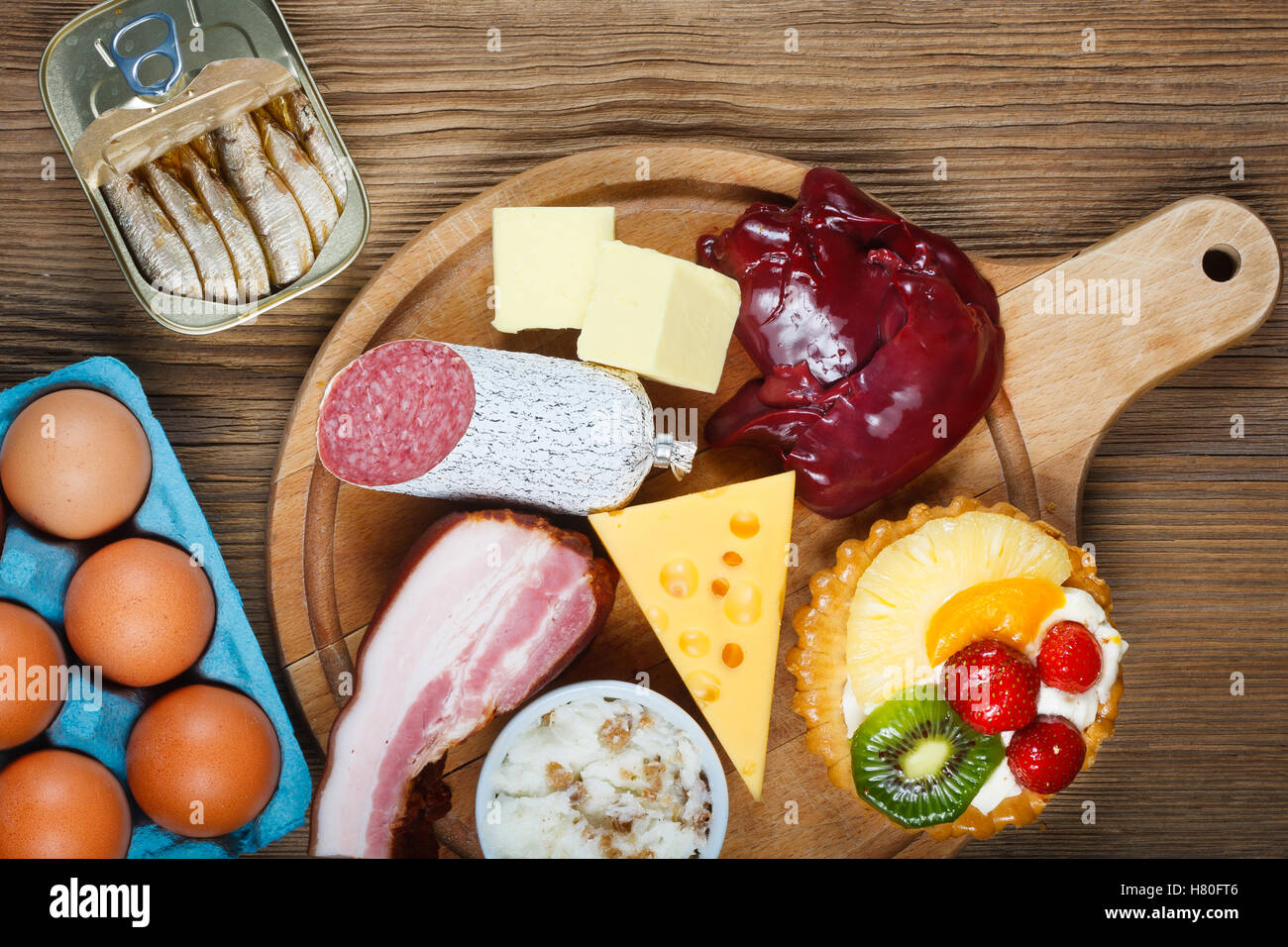 High-Cholesterol alimentos como los huevos, el hígado, el amarillo el queso, la mantequilla, el tocino, la manteca con cebolla, sardinas en aceite y cupcake con crema. Wo Foto de stock